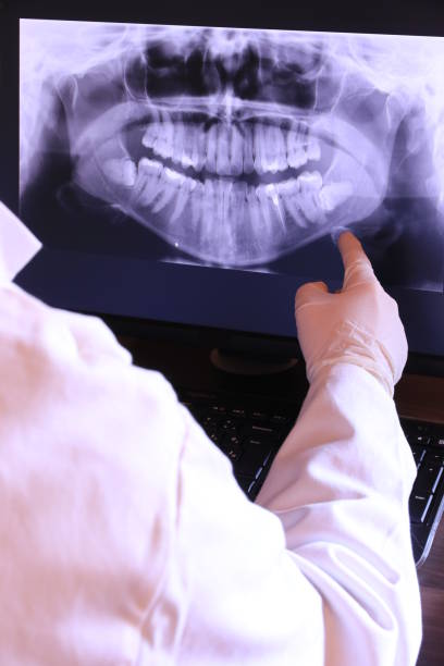 Best Emergency Denture Repair in Bedminster, NJ